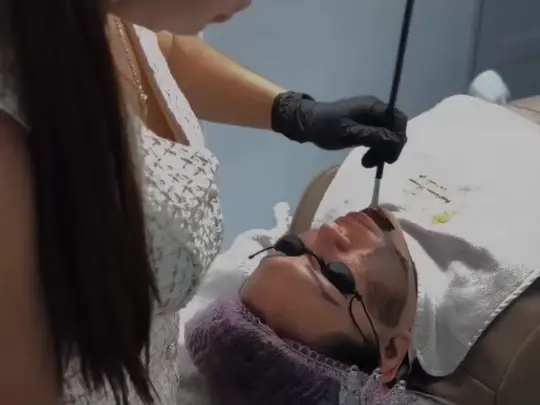 Tratamientos para cicatrices, estrías y queloides en Spabella Stetic