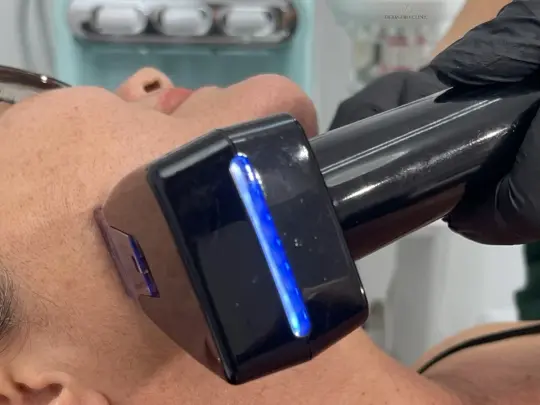 Morpheus 8 en Spabella Stetic